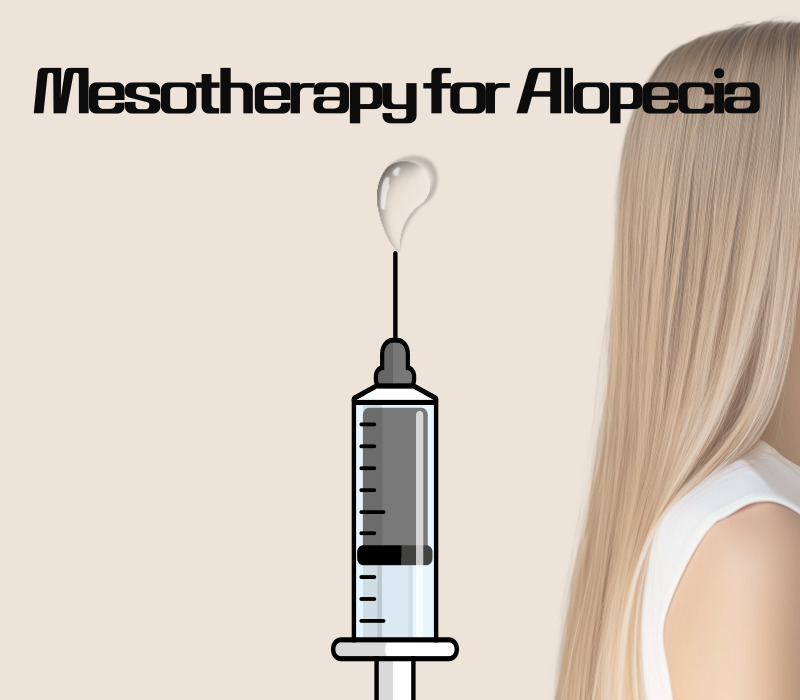 Mesotherapy for Alopecia
